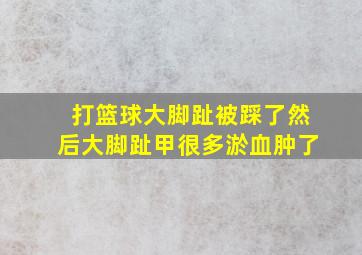 打篮球大脚趾被踩了然后大脚趾甲很多淤血肿了