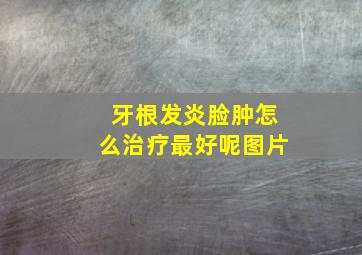 牙根发炎脸肿怎么治疗最好呢图片