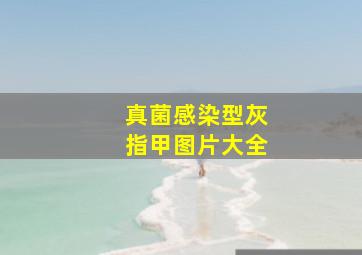 真菌感染型灰指甲图片大全