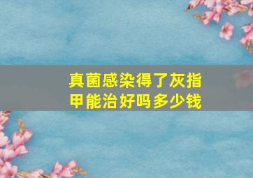 真菌感染得了灰指甲能治好吗多少钱